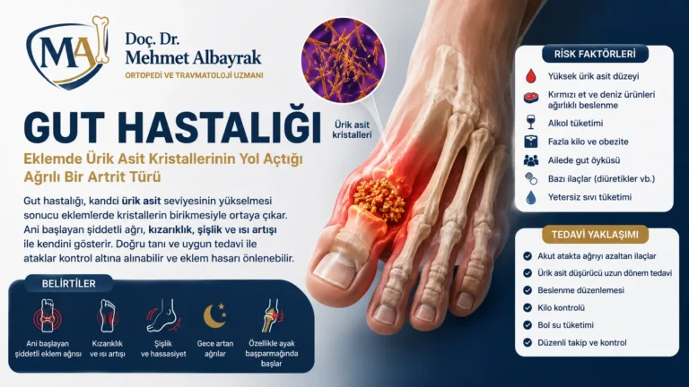 Gut Hastalığı Nedir? Belirtileri, Nedenleri ve Tedavisi